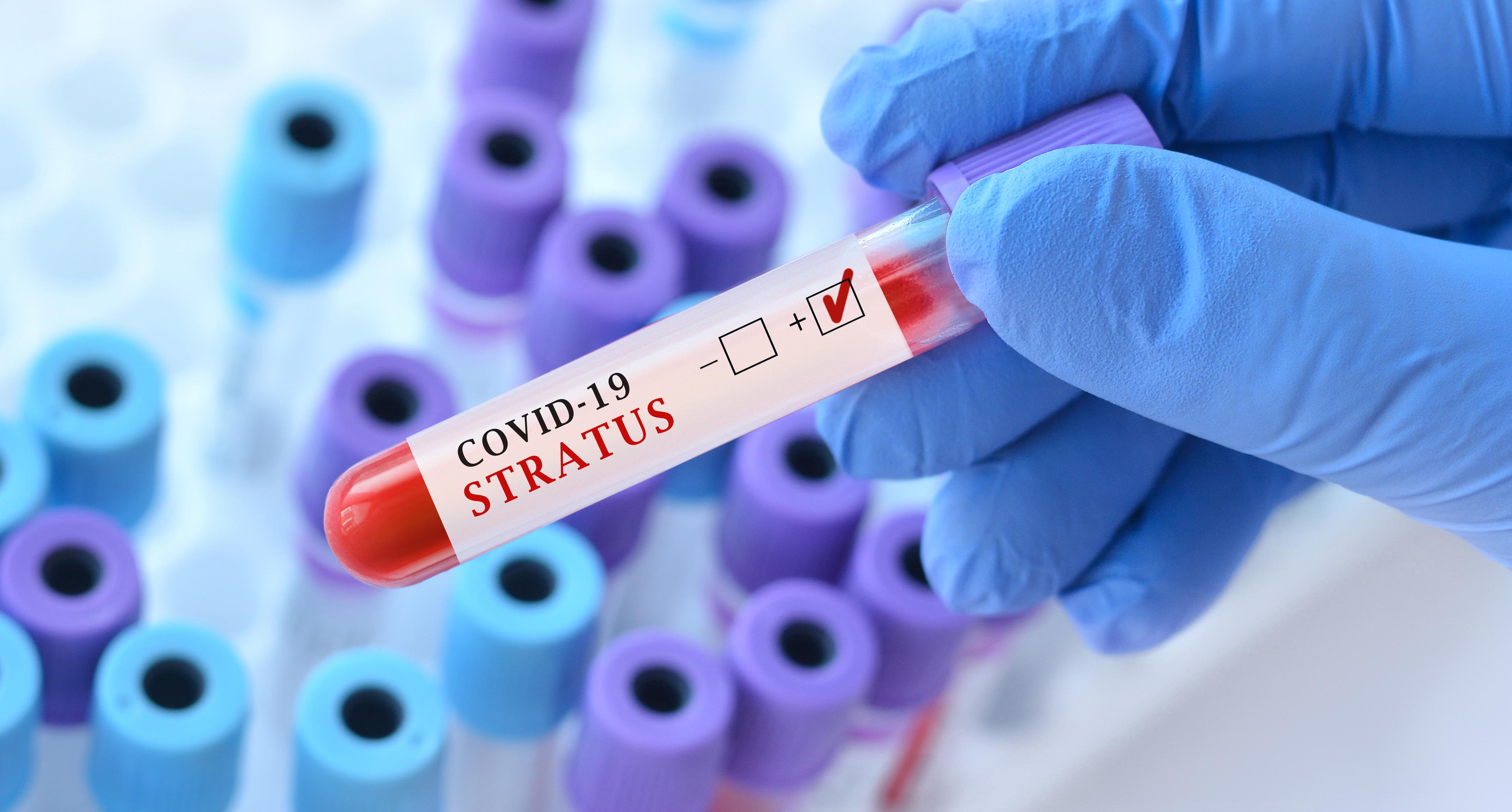 Covidový test 